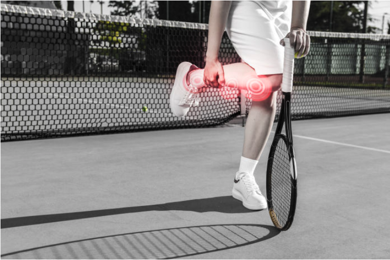 ¿Qué es la lesión Tennis Leg? ¿Cómo se produce? Síntomas y tratamientos.