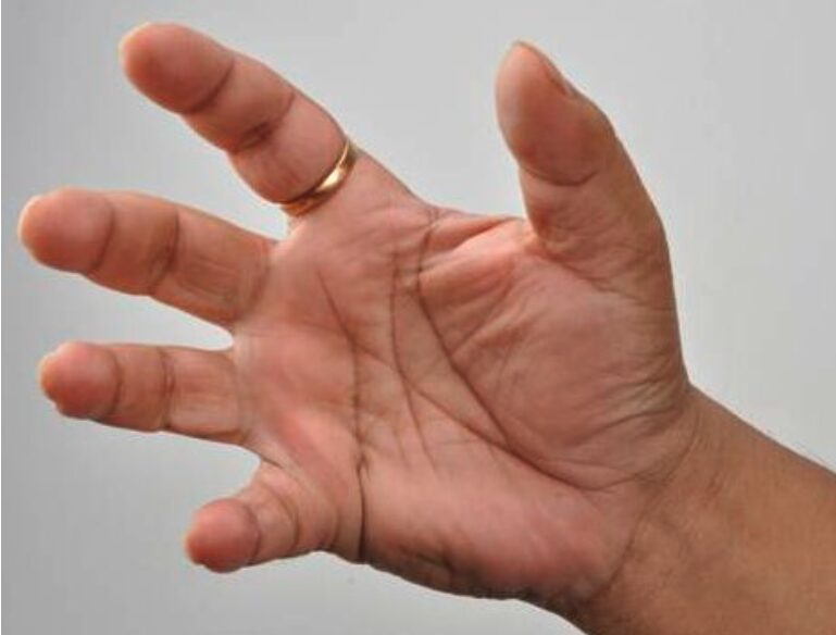 Mano abierta con los dedos extendidos, sobre fondo claro