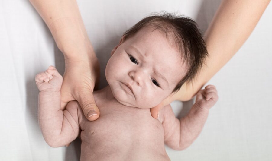 Congenital torticollis, what it is, symptoms, causes and treatments.