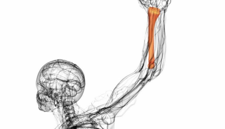 Ilustración por rayos X de un brazo con el cúbito y el radio resaltados