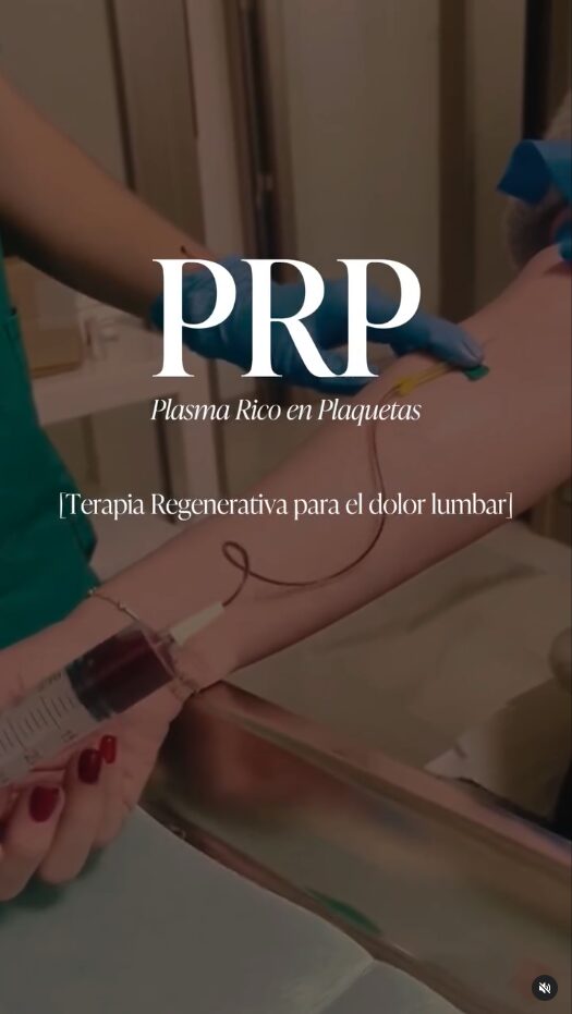 Portada del vídeo sobre PRP (plasma rico en plaquetas) como terapia regenerativa para el dolor lumbar, con una extracción de sangre a una paciente